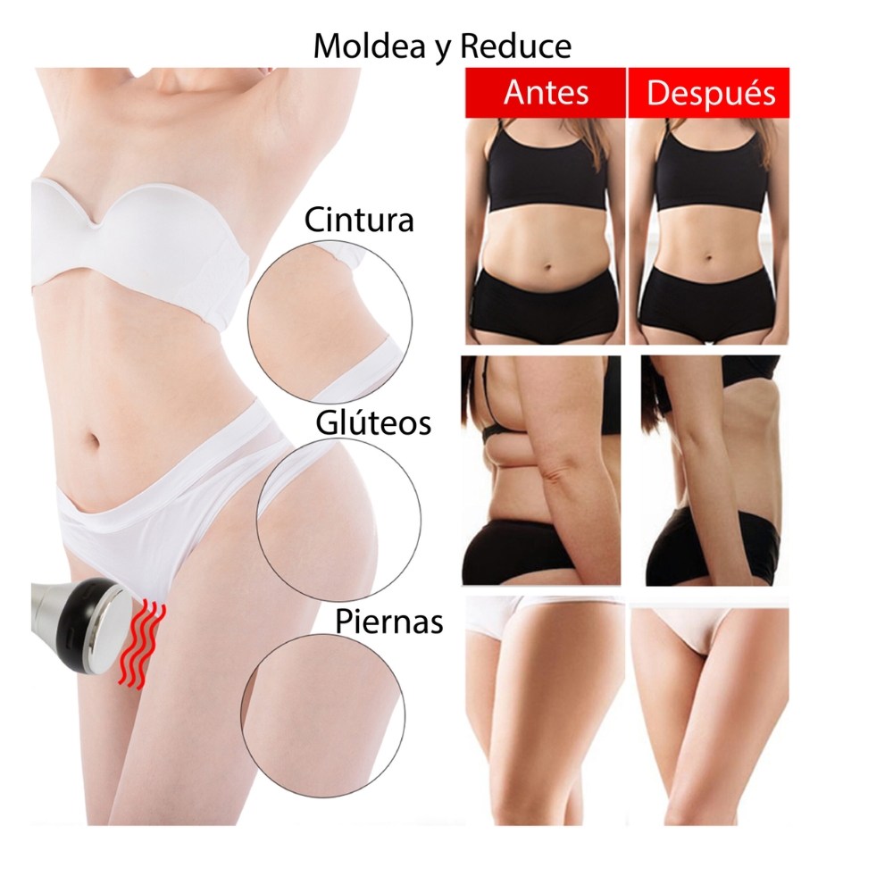 Cavitador Corporal 40k con Radiofrecuencia para Facial y Coporal - Imagen 4