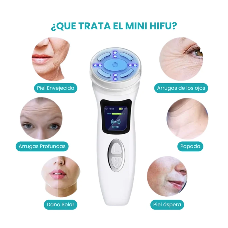 Mini HIFU Gen 2 Para Rejuvenecimiento Facial y Corporal - Imagen 4