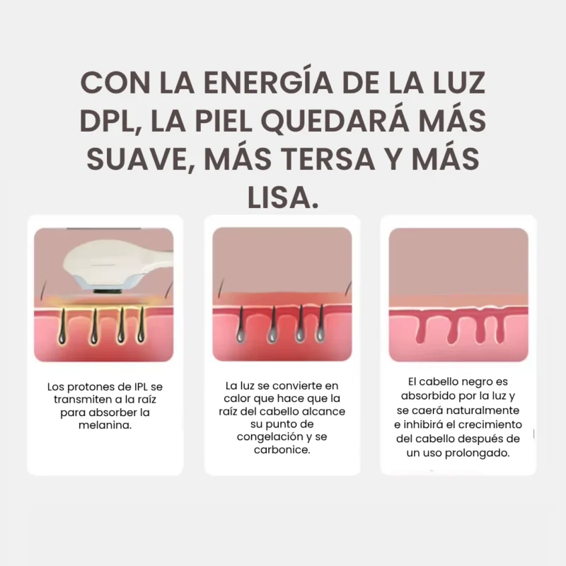 DPL Depilador, Manchas y Tatuajes 4000watts - Imagen 7