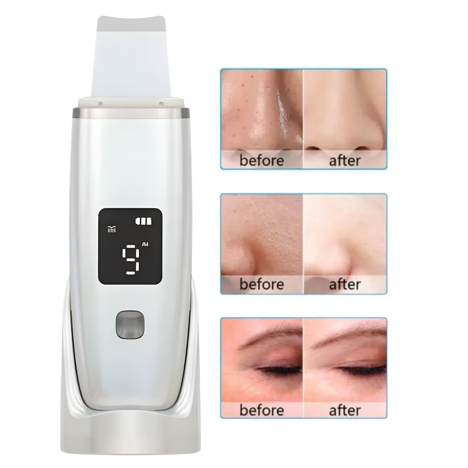 Skin Scrubber Digital y Tónico Facial Agua de Rosas 10ml - Imagen 2